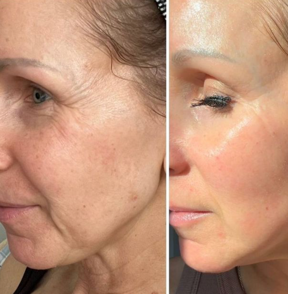 Luminis Editor™ Deep Collagen Booster